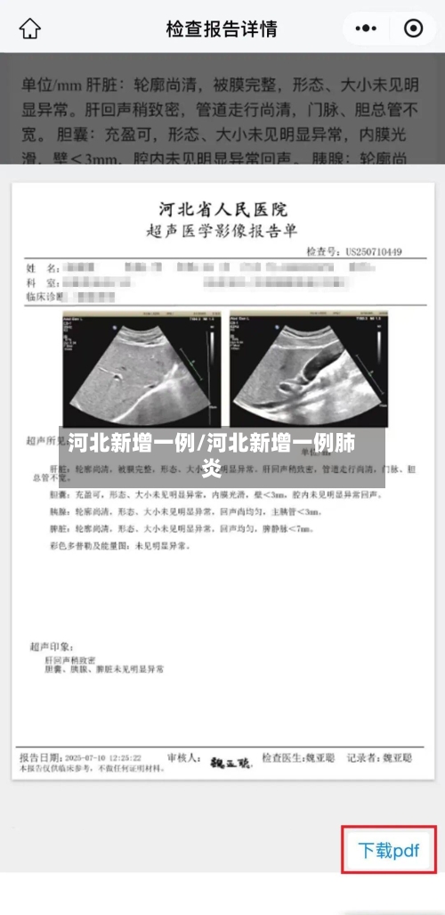 河北新增一例/河北新增一例肺炎-第2张图片